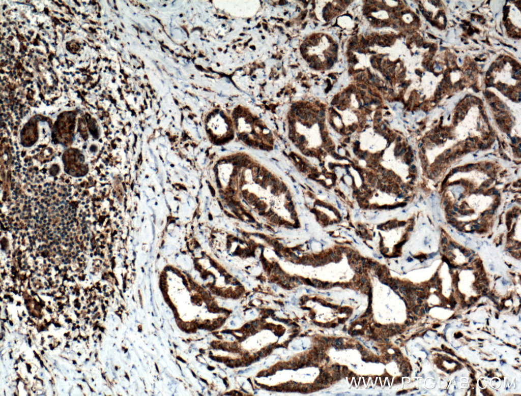 TMEM179 Polyclonal antibody