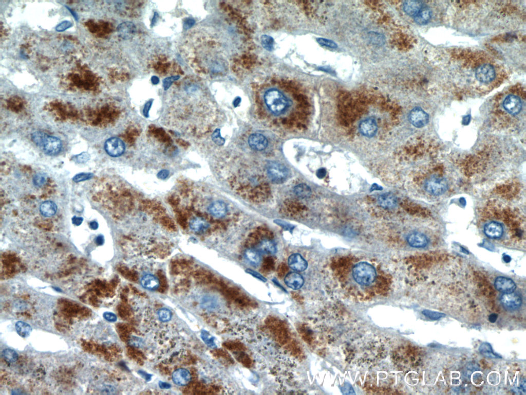 PXMP2 Polyclonal antibody