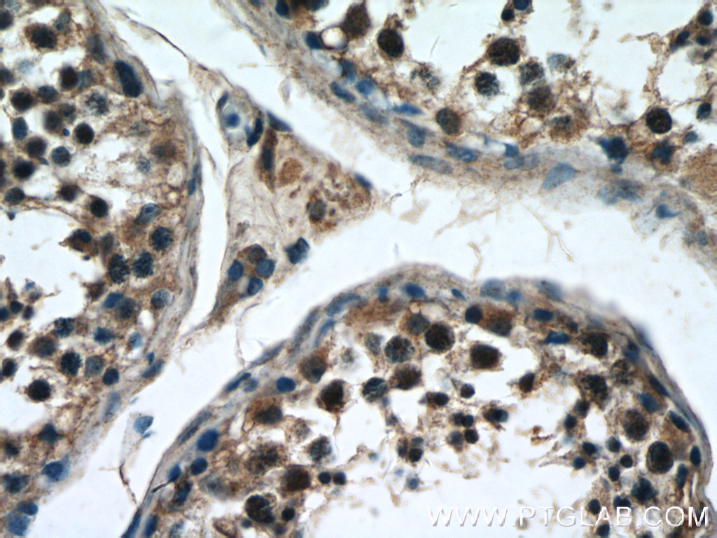 ZNF658 Polyclonal antibody