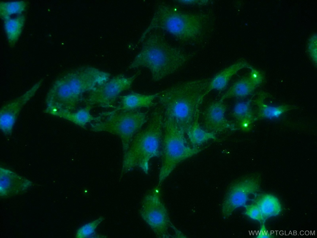 BAIAP3 Polyclonal antibody