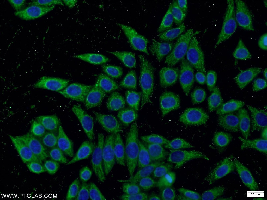 KLHDC5 Polyclonal antibody