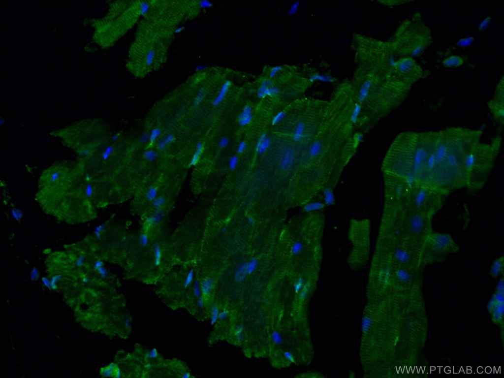 GAL3ST3 Polyclonal antibody