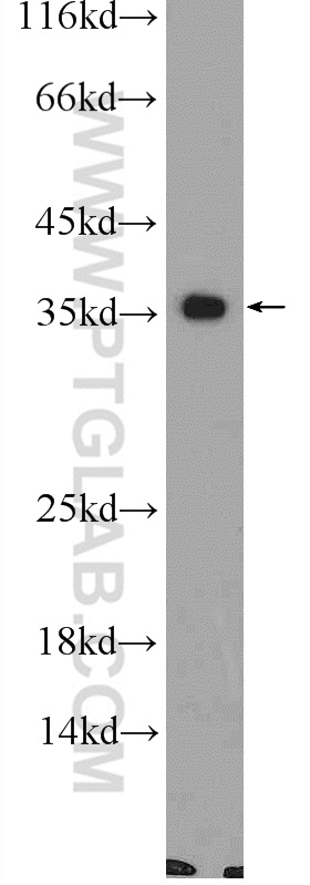 CNTD1 Polyclonal antibody