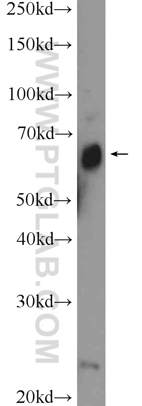 ZNF195 Polyclonal antibody