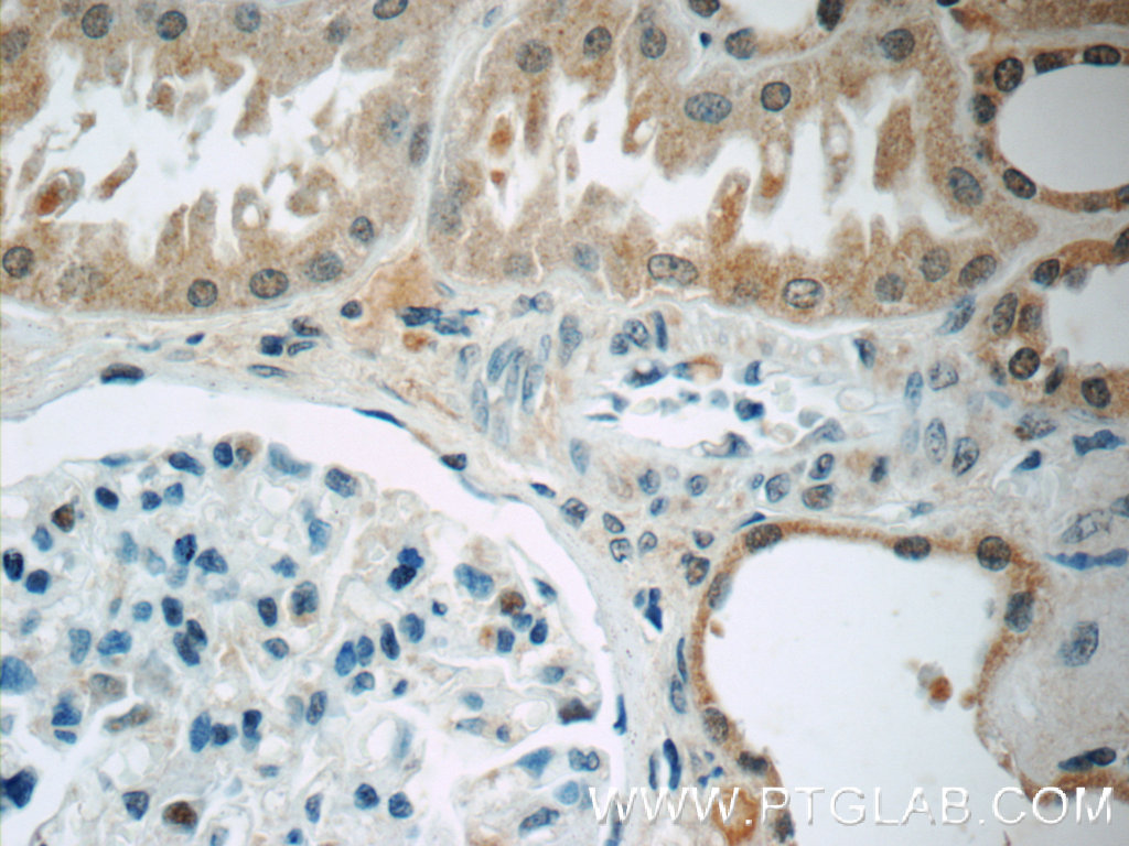 CWF19L2 Polyclonal antibody