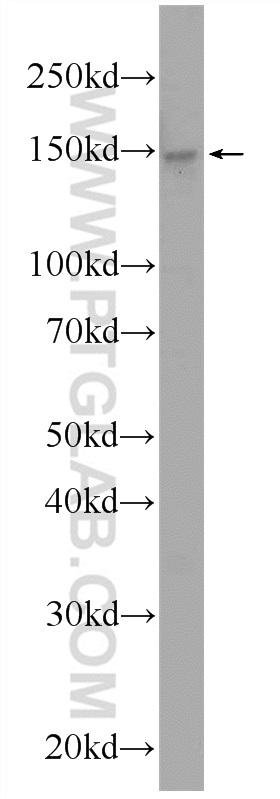 URB2 Polyclonal antibody