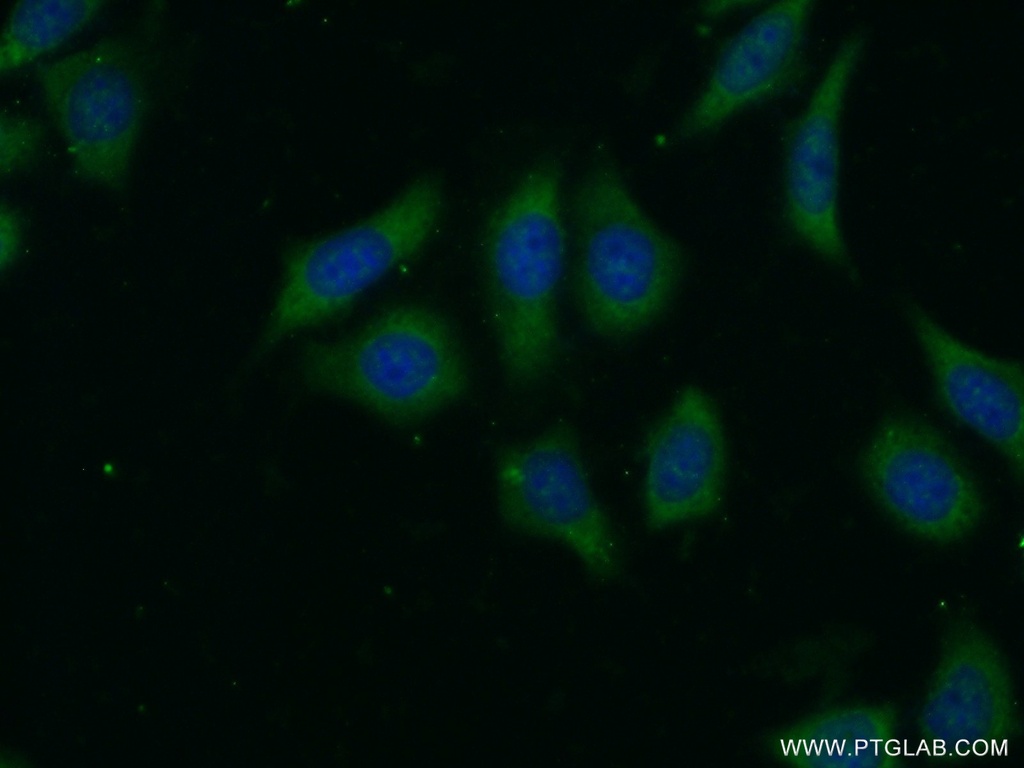 LRP5 Polyclonal antibody