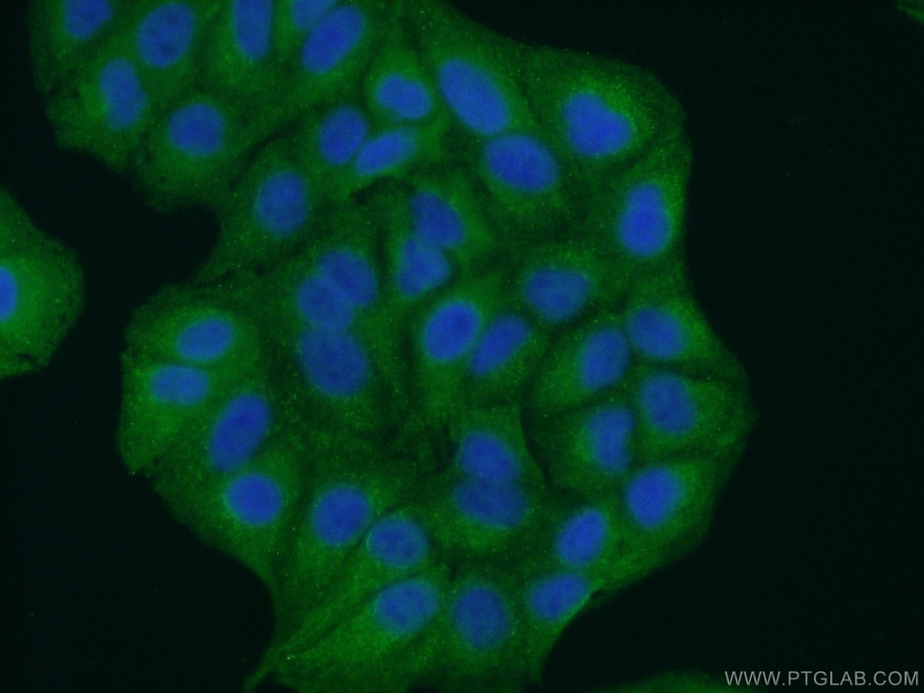 GRAMD1B Polyclonal antibody