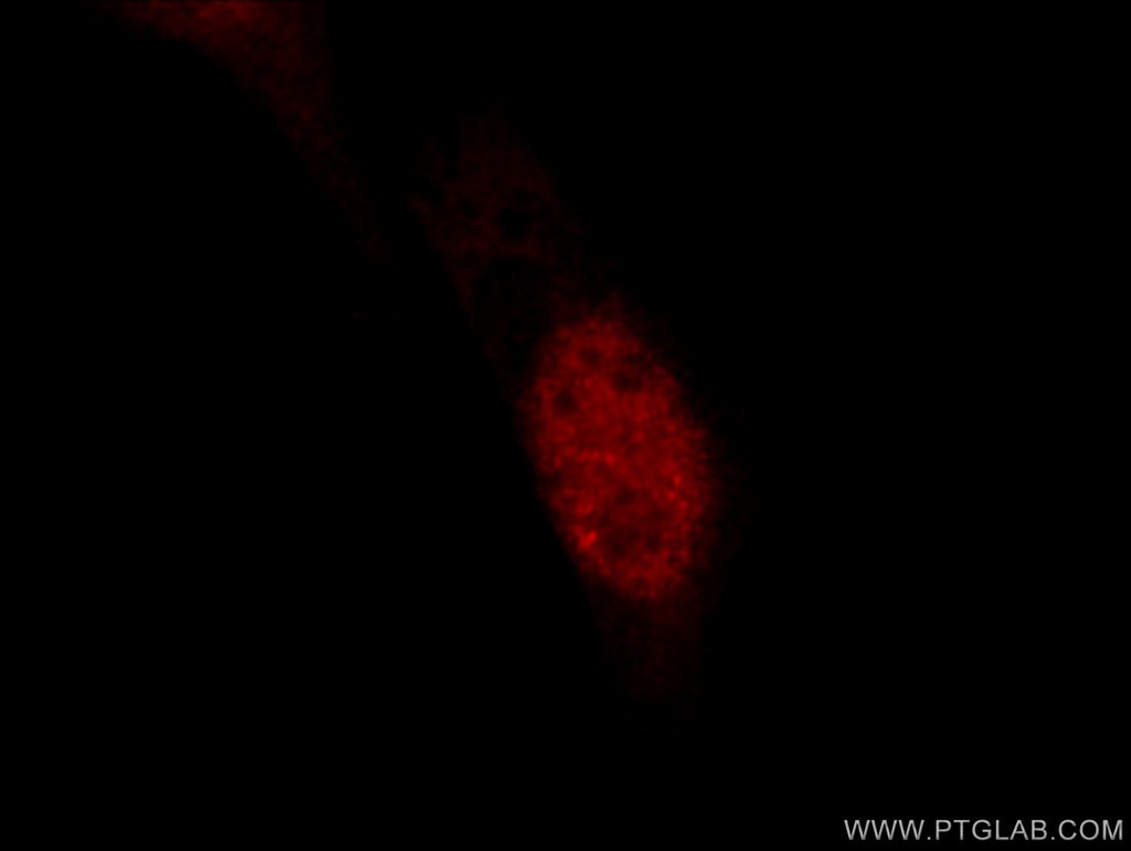 JUN Polyclonal antibody