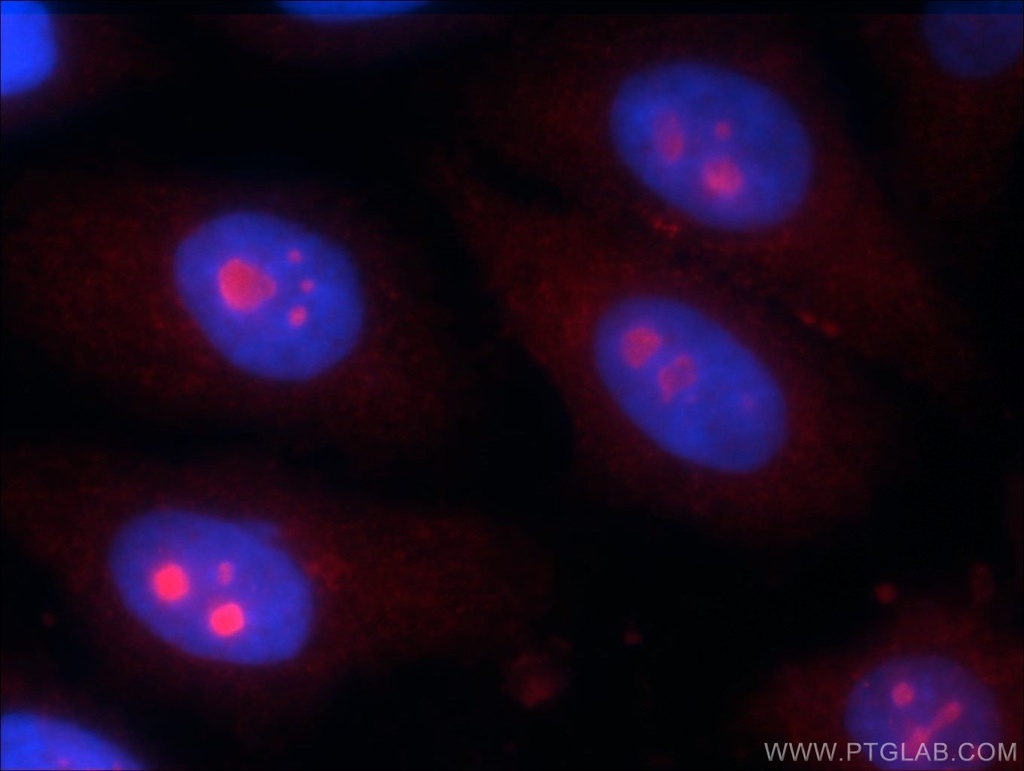 KIAA0774 Polyclonal antibody
