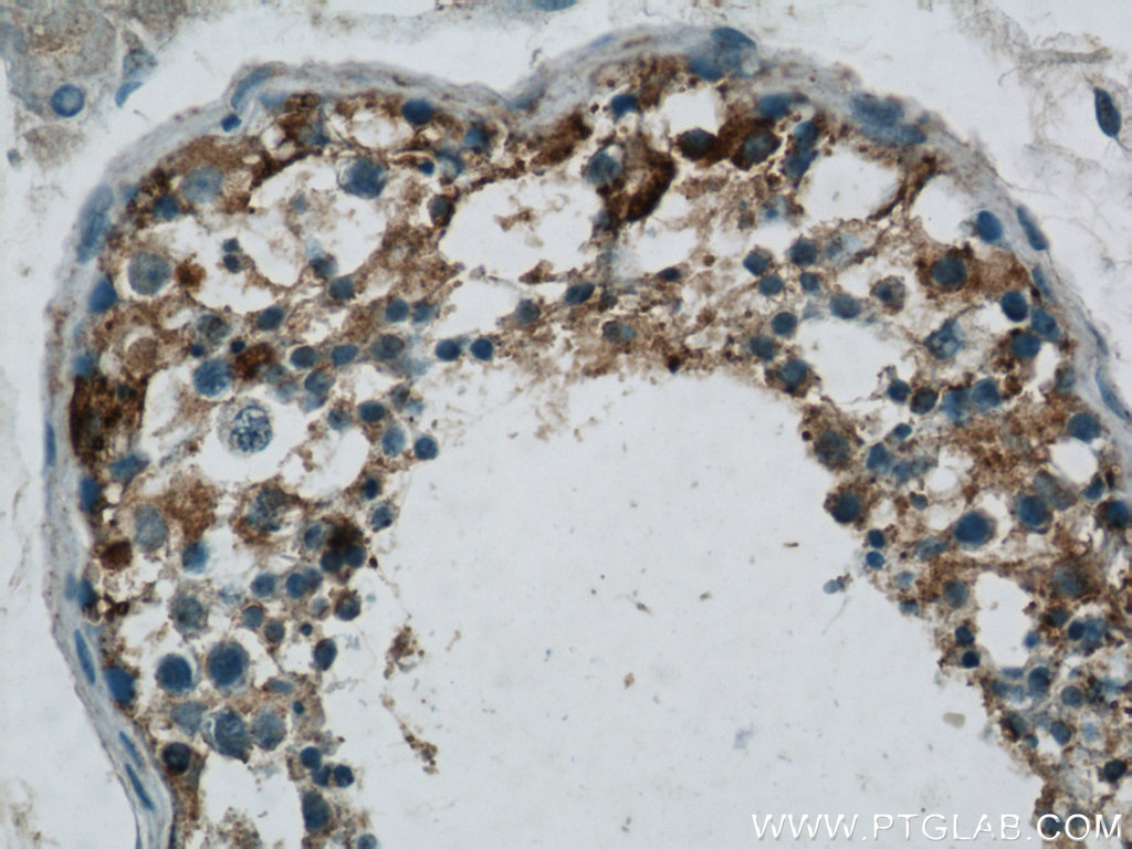 DHX35 Polyclonal antibody