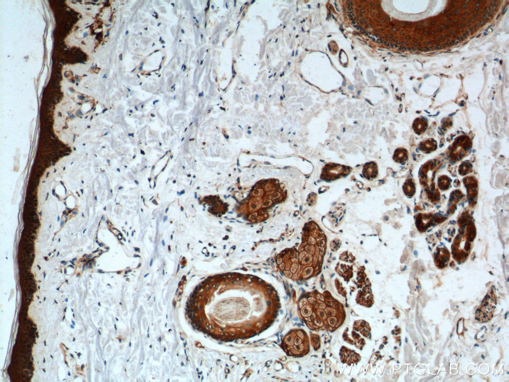 ST3GAL3 Polyclonal antibody