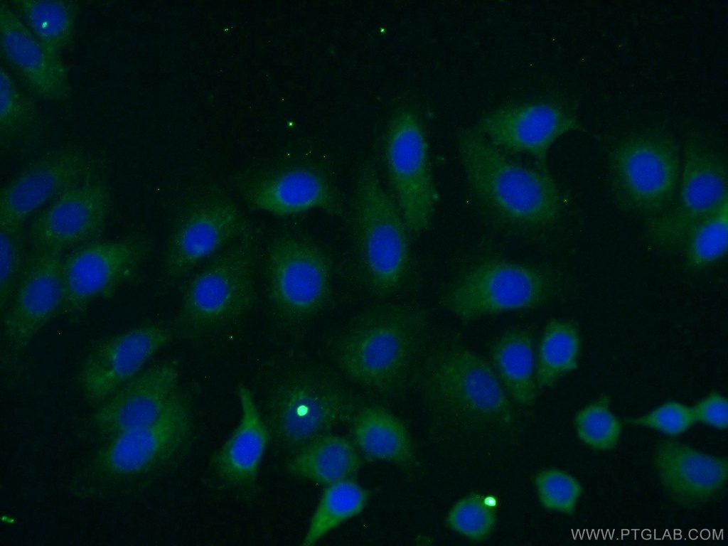 ILK Polyclonal antibody