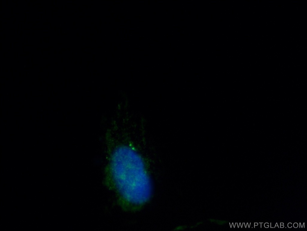 CEP112 Polyclonal antibody