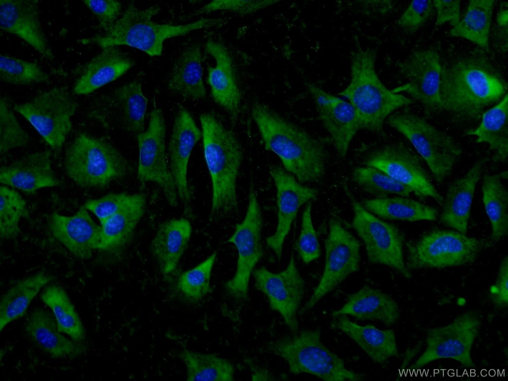 ADAMTS12 Polyclonal antibody