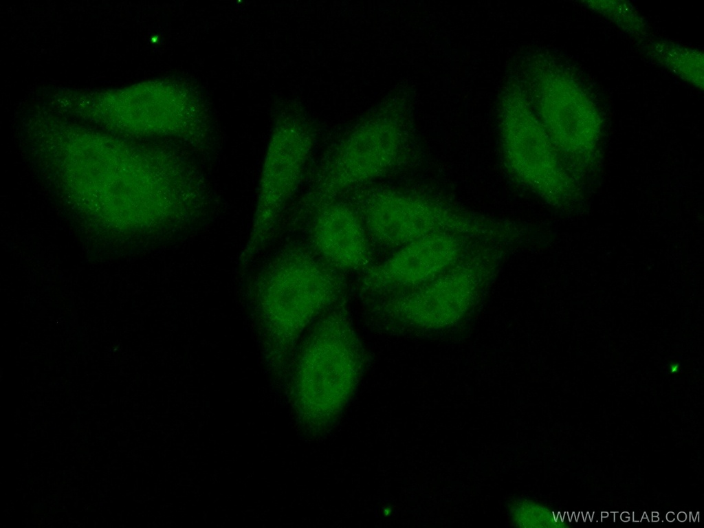 PRPF38A Polyclonal antibody