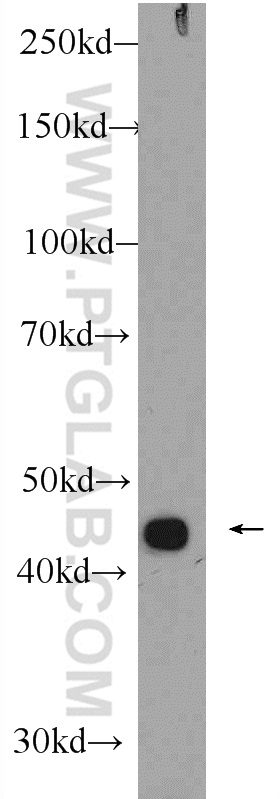 ZNF114 Polyclonal antibody