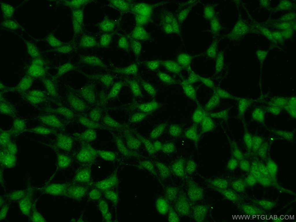 RNF219 Polyclonal antibody
