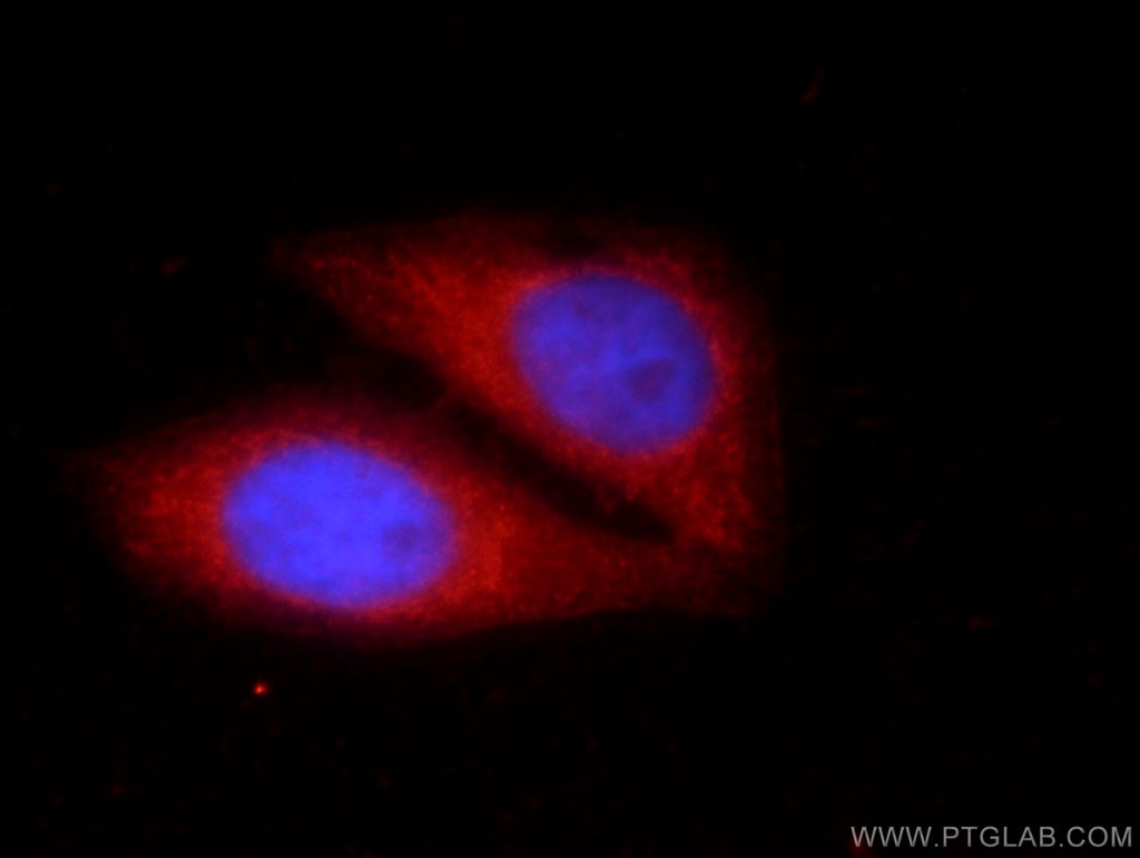 KHDC3L Polyclonal antibody