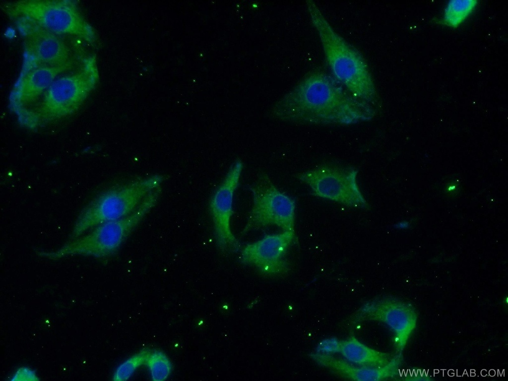 HuD-specific Polyclonal antibody