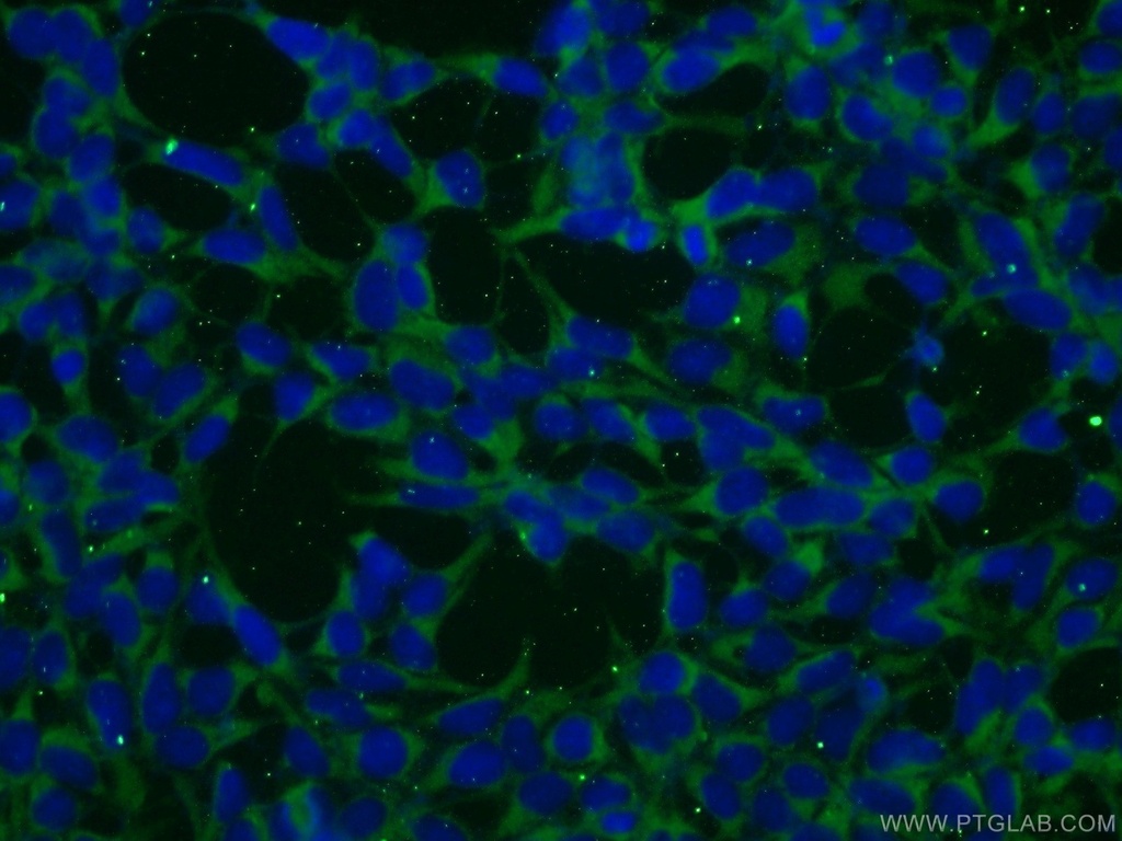BAALC Polyclonal antibody