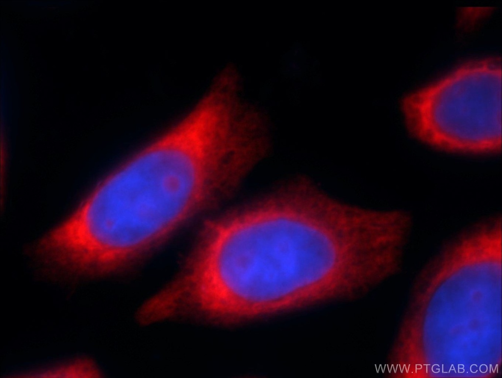 RPL22 Polyclonal antibody