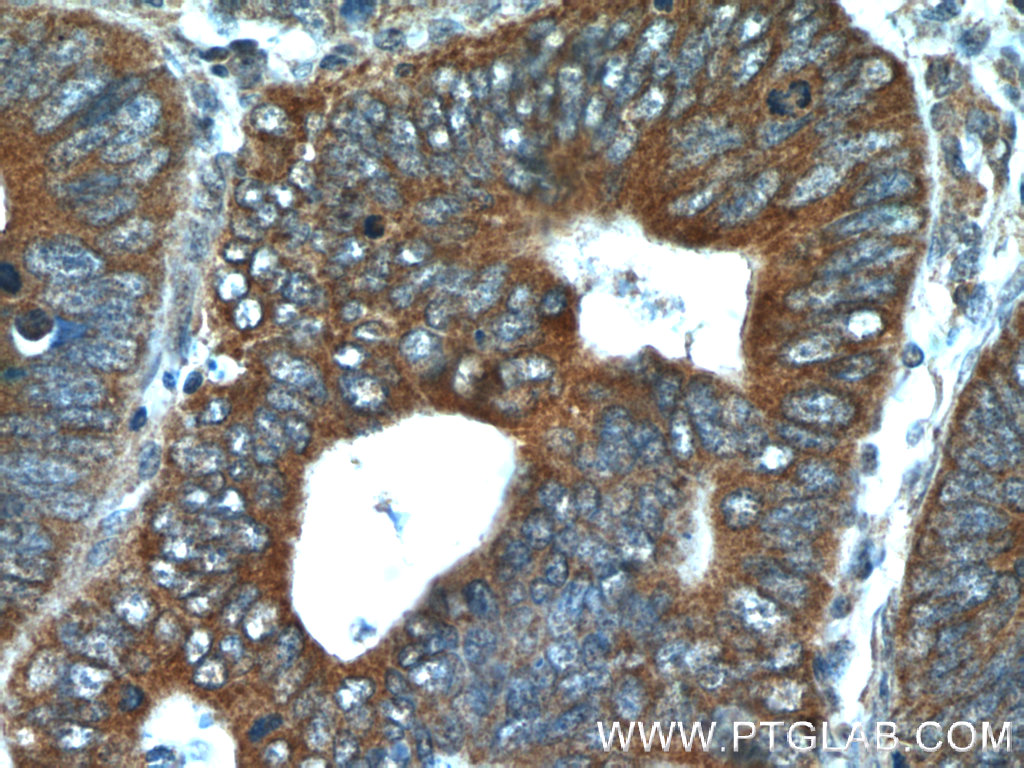 FGFBP1 Polyclonal antibody