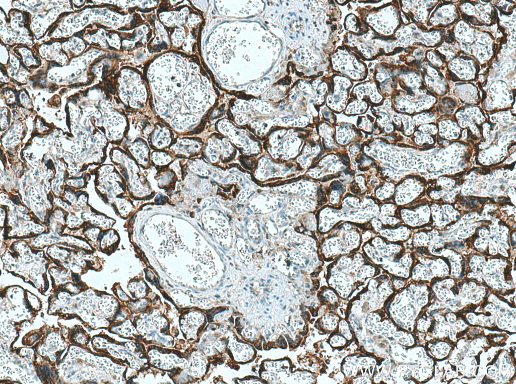 hCG Alpha Polyclonal antibody