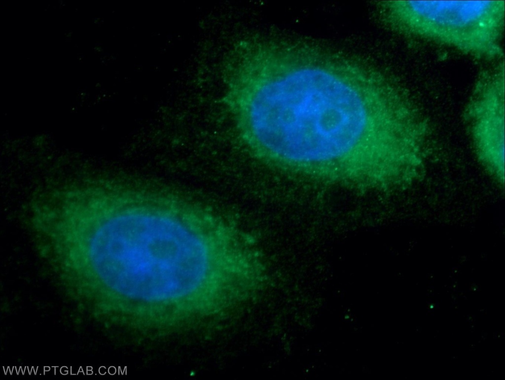 ANKRD49 Polyclonal antibody