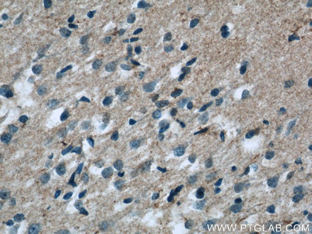ARMETL1 Polyclonal antibody