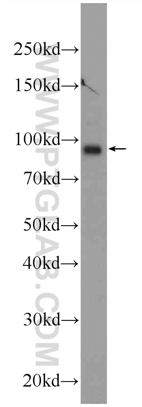 TMCC2 Polyclonal antibody