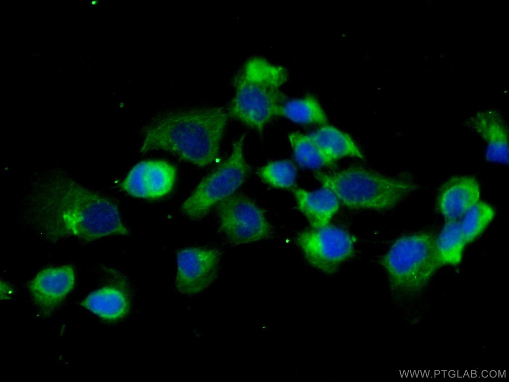 CAPZB Polyclonal antibody