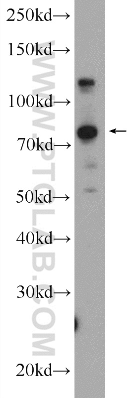 KIAA1530 Polyclonal antibody