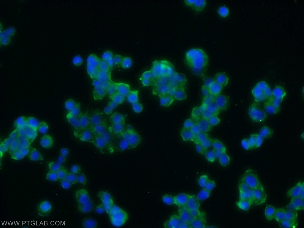ARRDC3 Polyclonal antibody