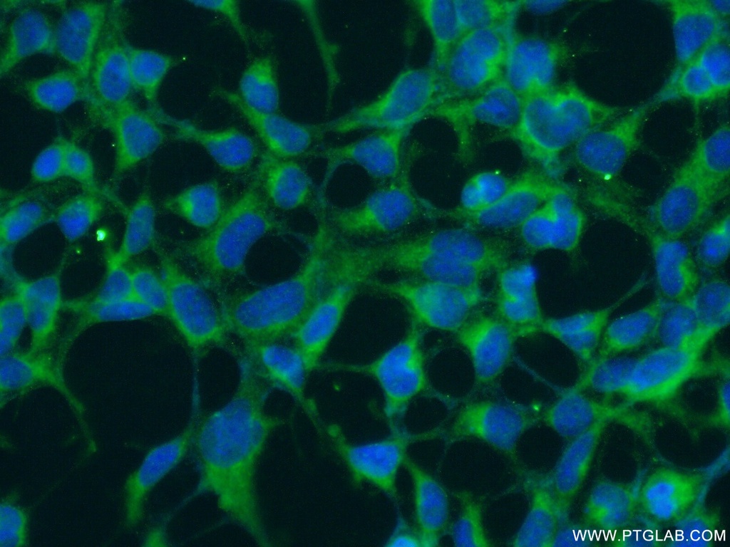 RNF135 Polyclonal antibody