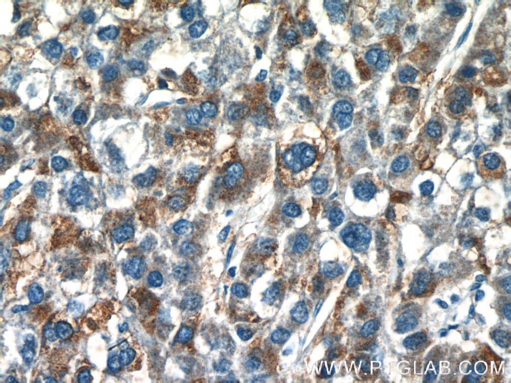 GDPD2 Polyclonal antibody