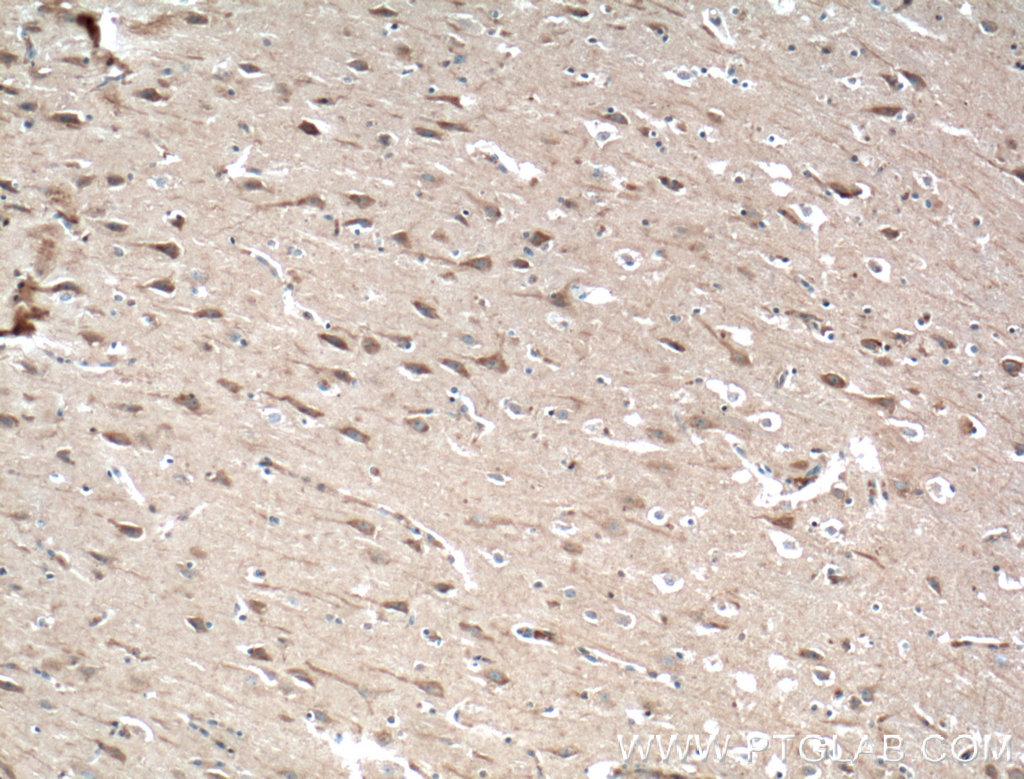 SIPA1L1 Polyclonal antibody