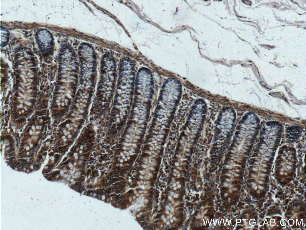DOCK6 Polyclonal antibody