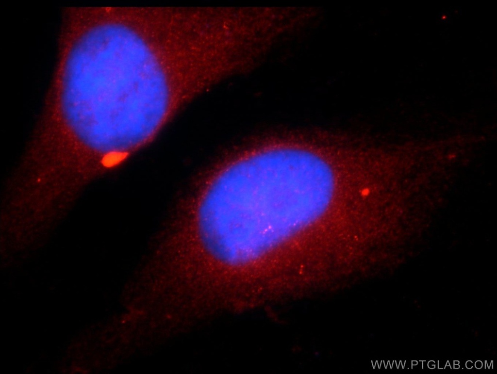 ZNF277 Polyclonal antibody