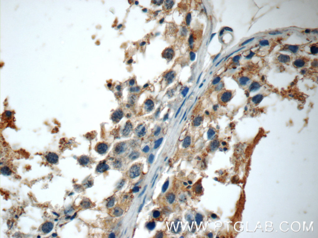 ODF3 Polyclonal antibody