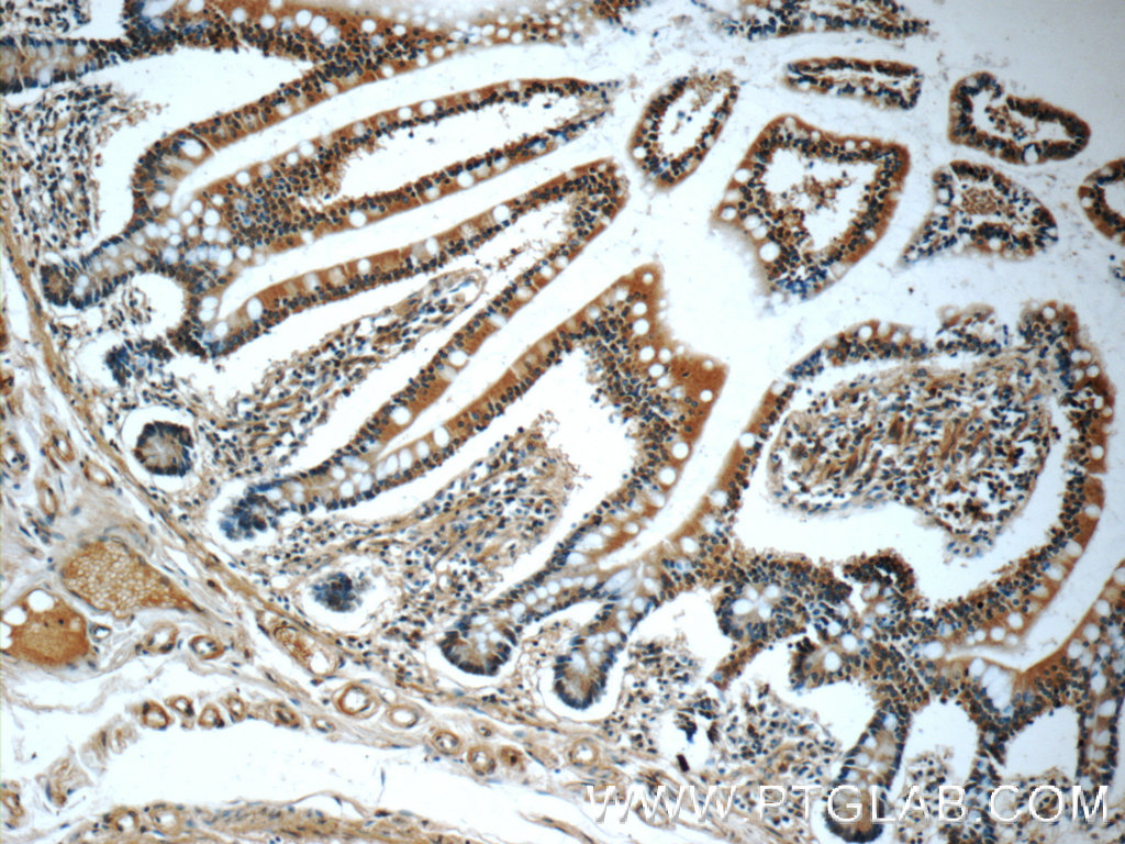 MGAT4A Polyclonal antibody