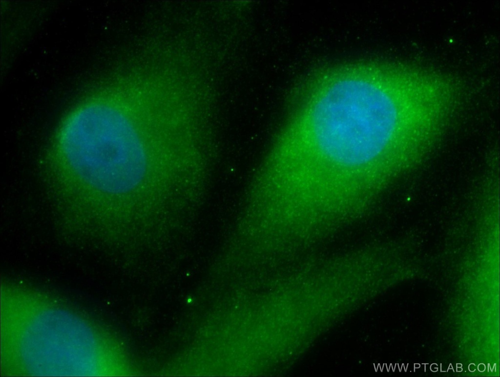 DNAJB13 Polyclonal antibody