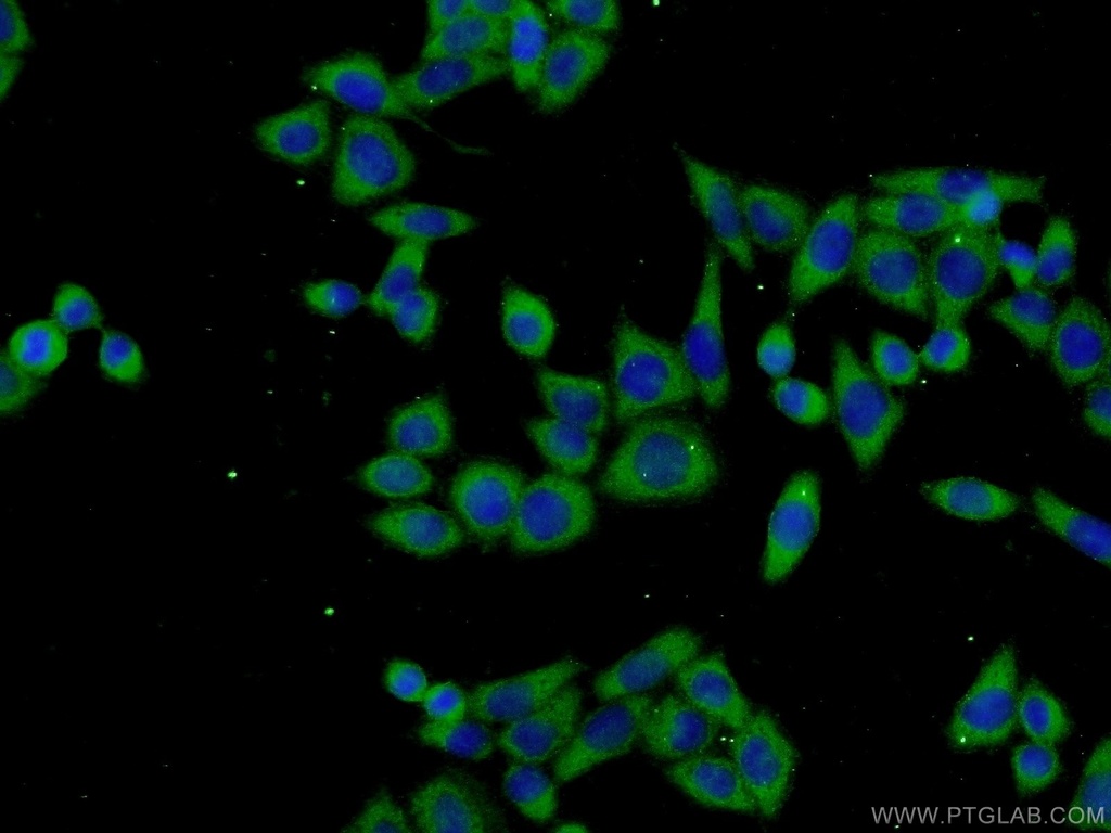 TPTE2 Polyclonal antibody