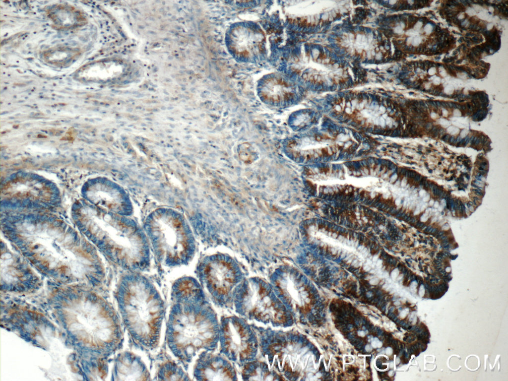 FIBCD1 Polyclonal antibody