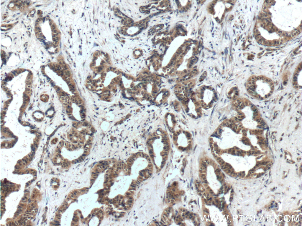 WDFY3 / ALFY Polyclonal antibody