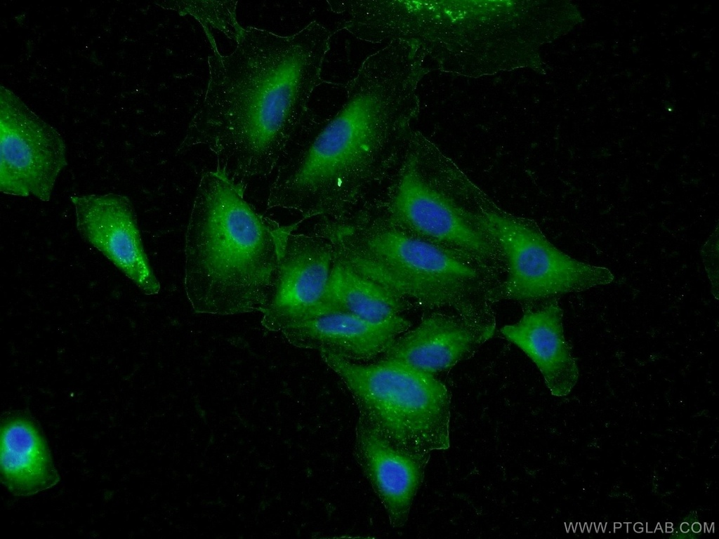 DAPK1 Polyclonal antibody
