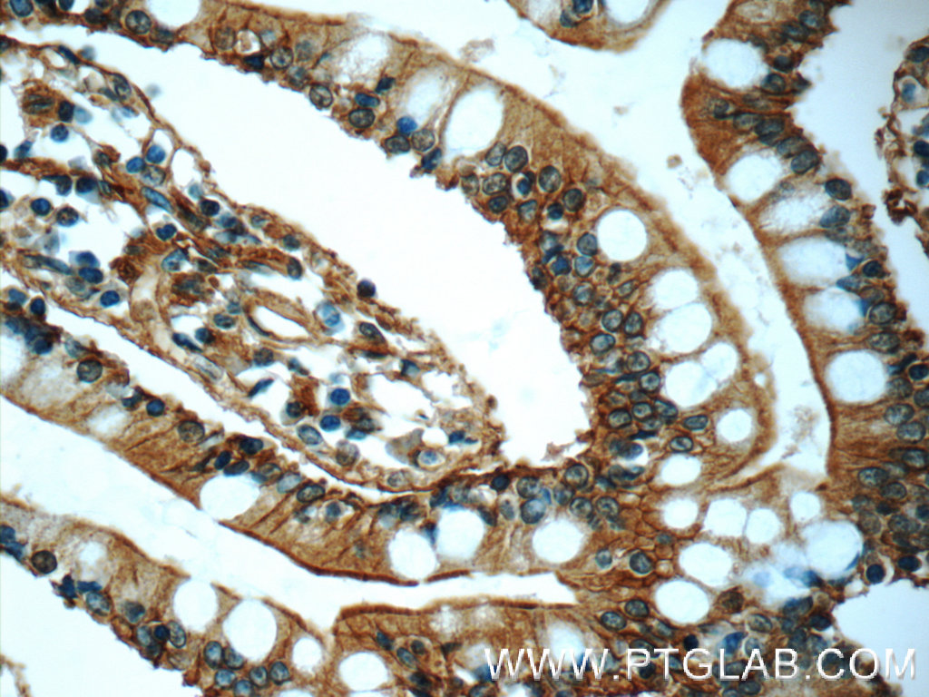 Annexin A13 Polyclonal antibody