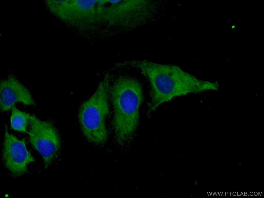 DNAJC18 Polyclonal antibody