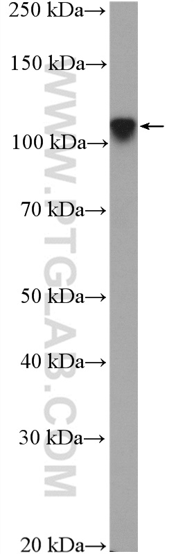 ZNF711 Polyclonal antibody