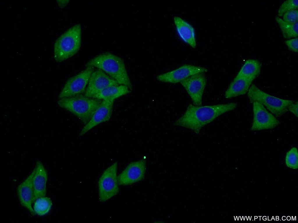 ALDH1A3 Polyclonal antibody